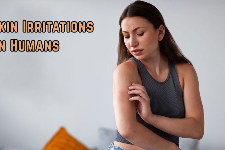 Skin Irritations on Humans