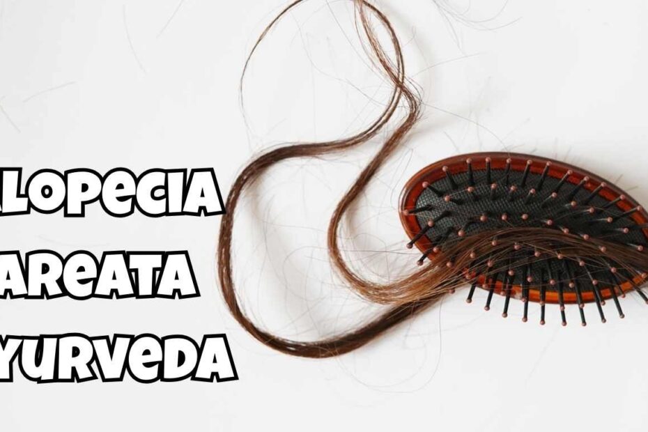 Alopecia Areata Ayurveda