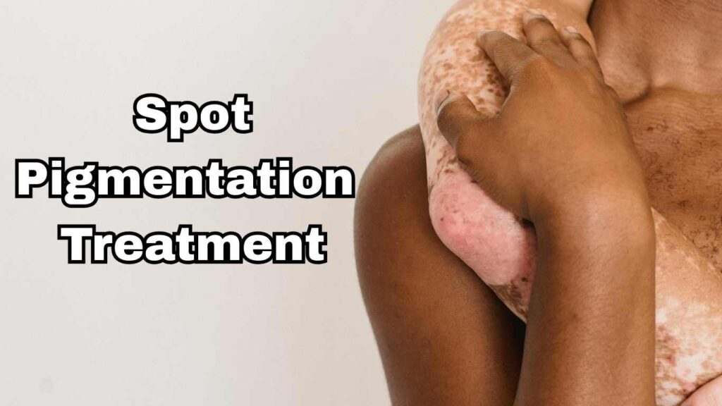 Spot Pigmentation Treatment