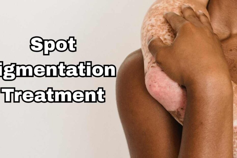 Spot Pigmentation Treatment
