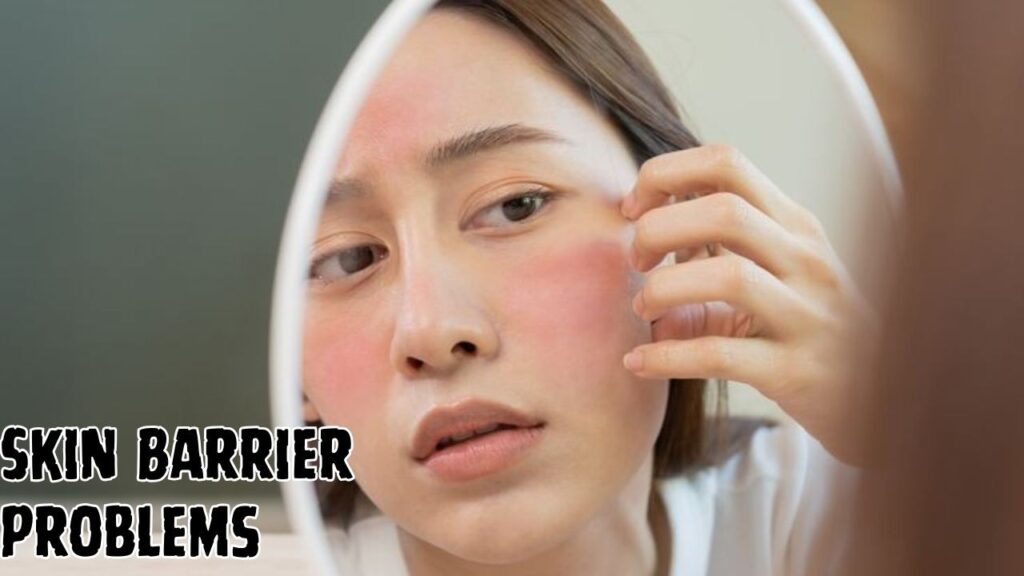 Skin Barrier Problems