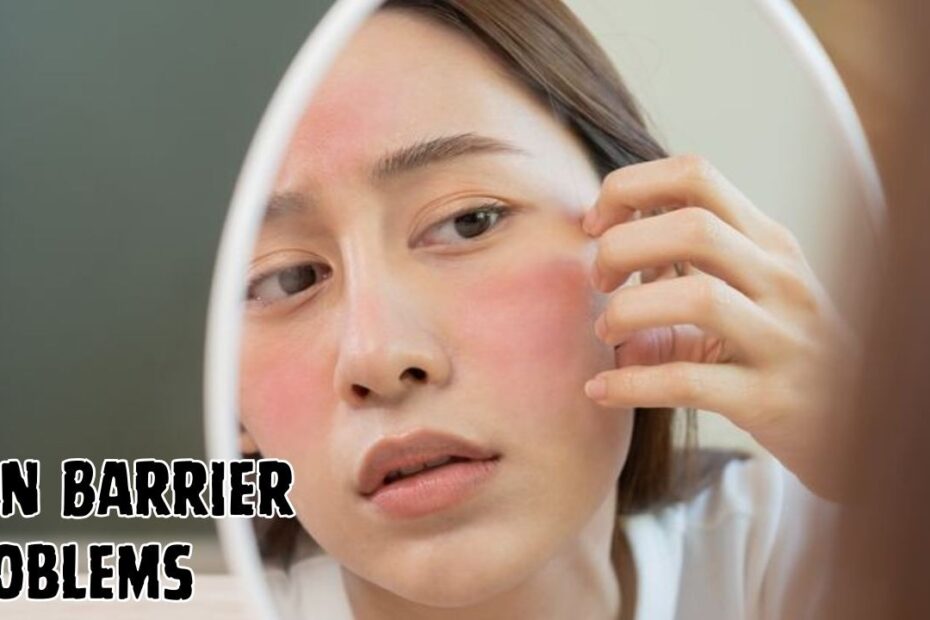 Skin Barrier Problems