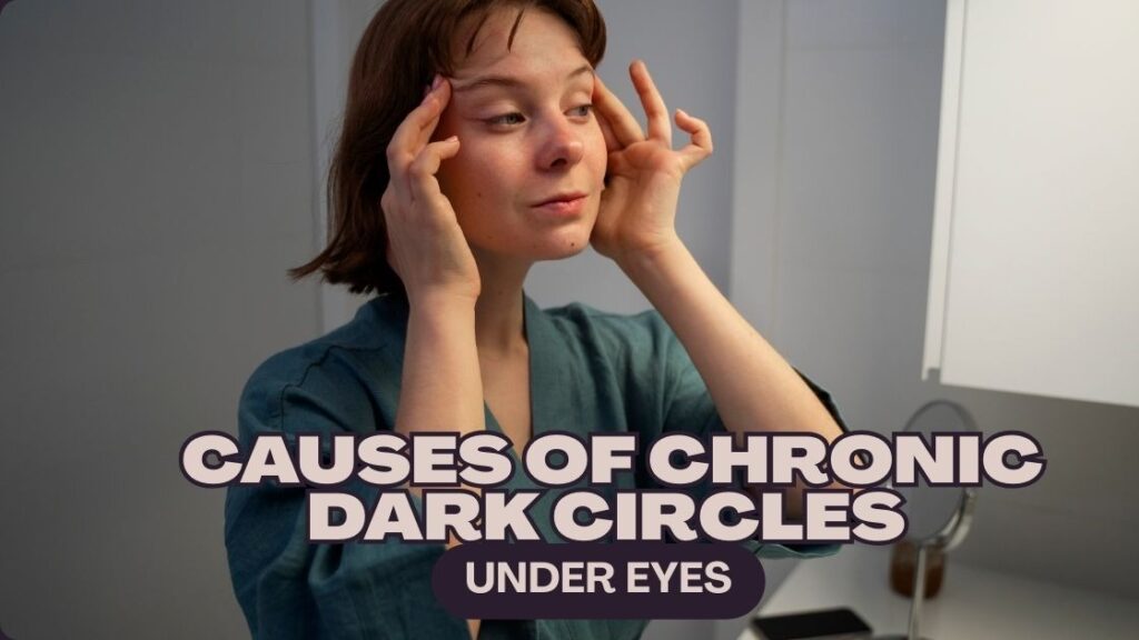 causes of chronic dark circles under eyes