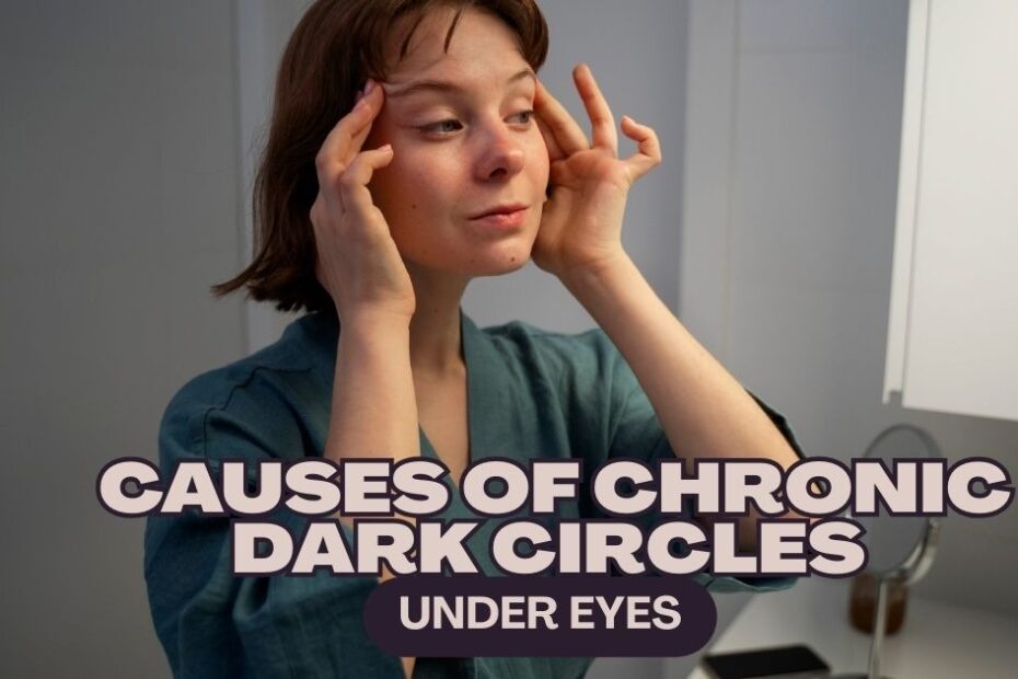 causes of chronic dark circles under eyes