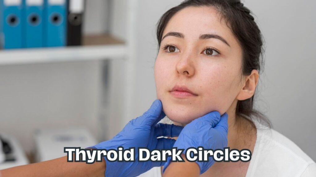 thyroid dark circles