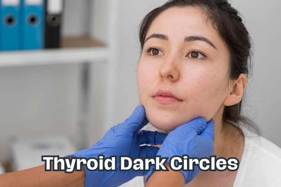 thyroid dark circles