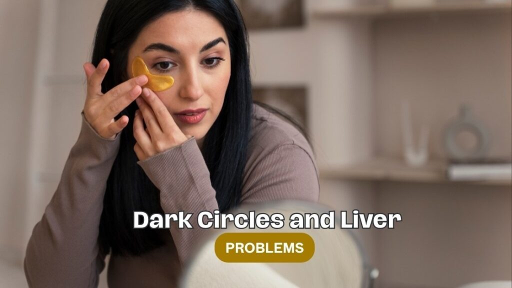 dark circles and liver problems