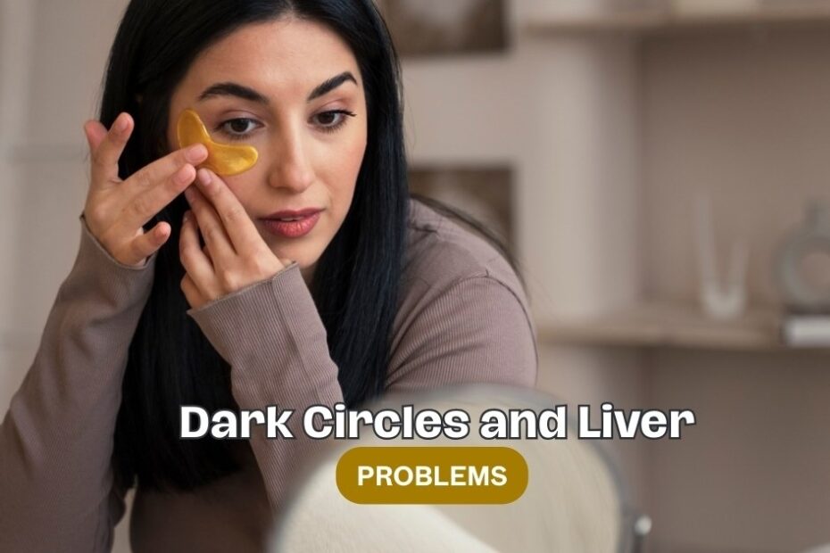 dark circles and liver problems