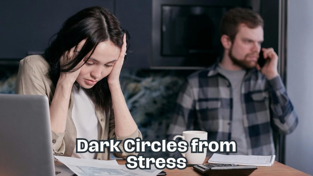dark circles from stress