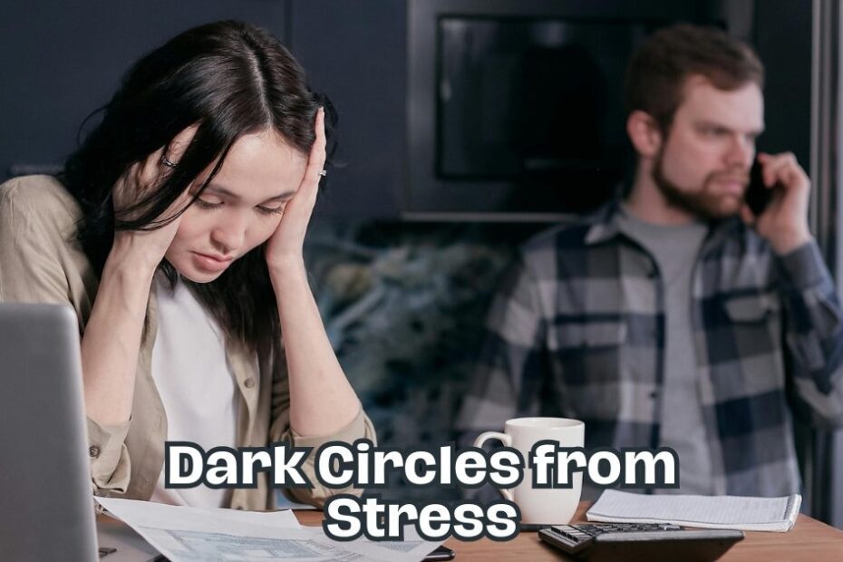dark circles from stress