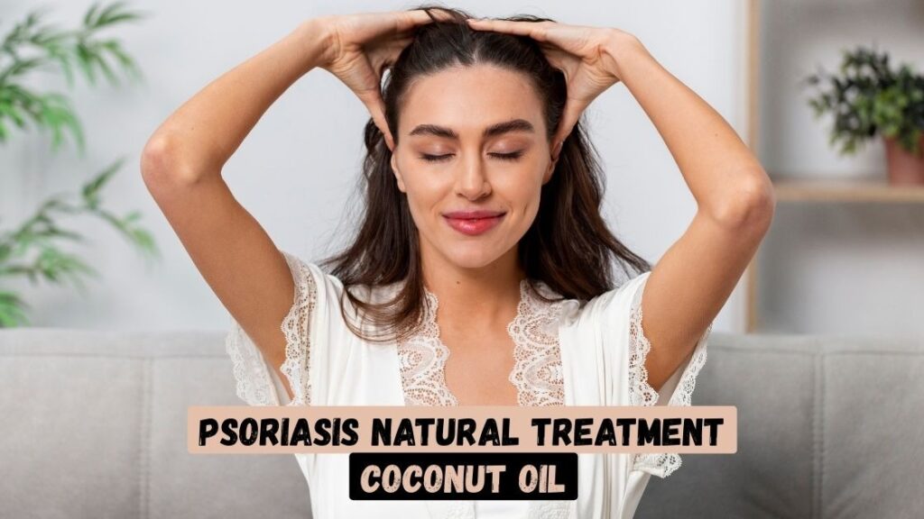 Psoriasis Natural Treatment Coconut Oil