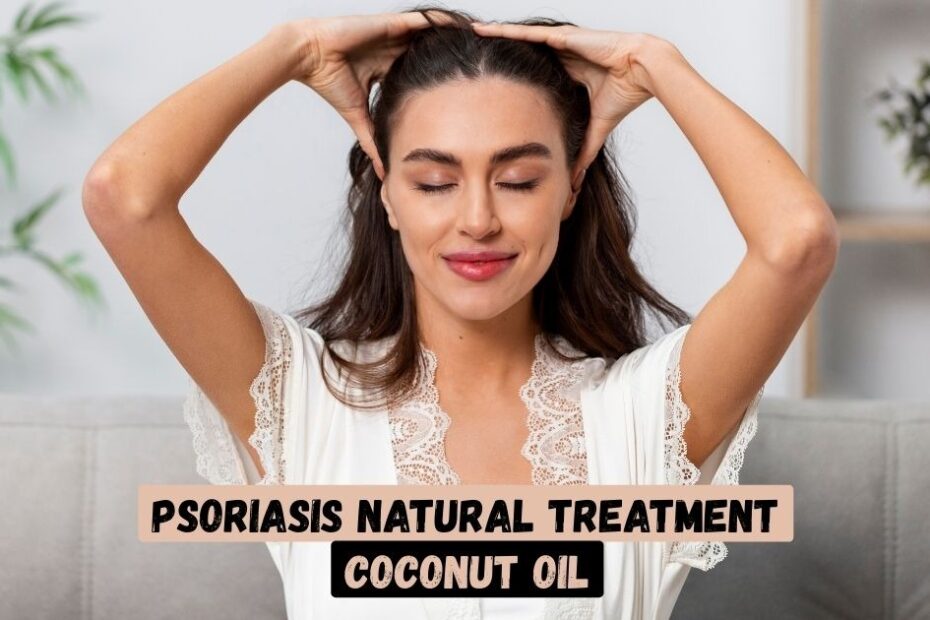 Psoriasis Natural Treatment Coconut Oil